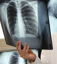 Doctor holding a chest X-ray