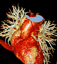 Heart-cardiology