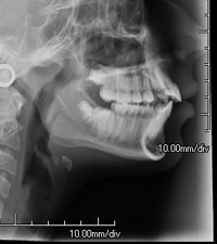 Maxillofacial radiography