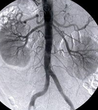 Kidney radiography